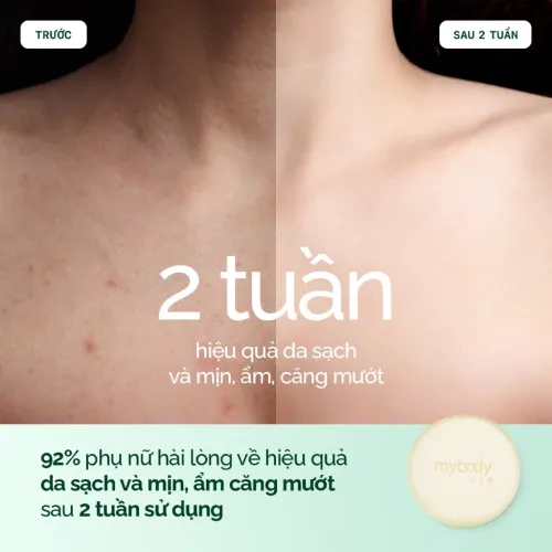 Xà Phòng Sữa Dê Hữu Cơ Pháp My Body VIP. Dịu Nhẹ, Dưỡng Ẩm Cho Mọi Loại Da | Organic 100g