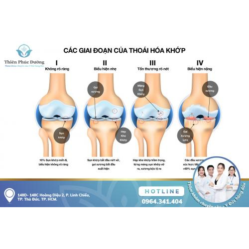 Các Bệnh Lý Xương Khớp Thường Gặp Và Dấu Hiệu Nhận Biết